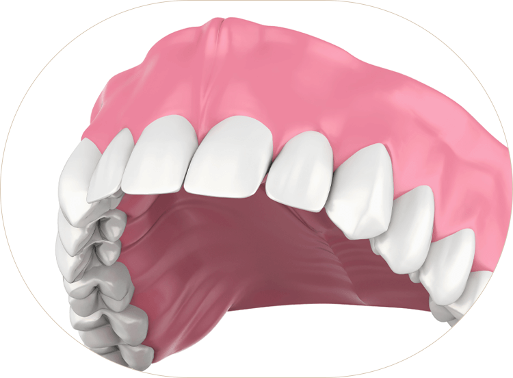 illustration of full dentures