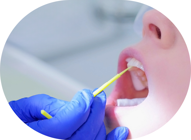dental patient getting a fluoride treatment